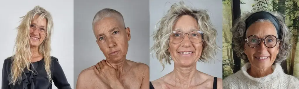 Min rejse med kræft – fra skjoldbruskkirtelkræft til brystkræft